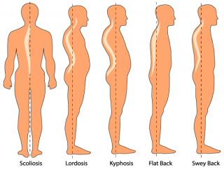 Are These A Listers Hiding A Back Condition Lumbar Lordosis - tlb0u9i